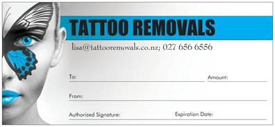 Frequently Asked Questions | Tattoo Removals Auckland