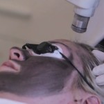 Carbon Laser Facial Treatment
